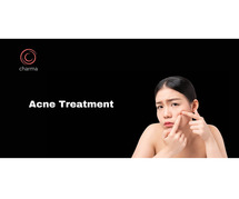 Acne Treatment in Bangalore
