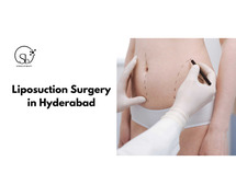 Liposuction surgery in Hyderabad
