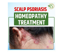 Unlocking Relief: Homeopathy Presents Promising Solution for Psoriasis Management