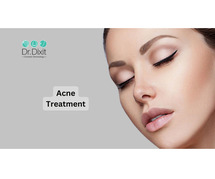 Acne Treatment In Bangalore