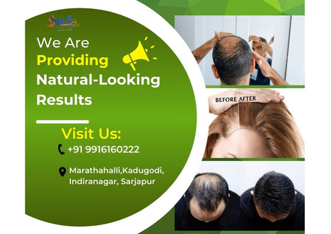 Natural-Looking Results: Hair Fixing Services Available @Sarjapur