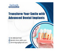 Transform Your Smile with Advanced Dental Implants