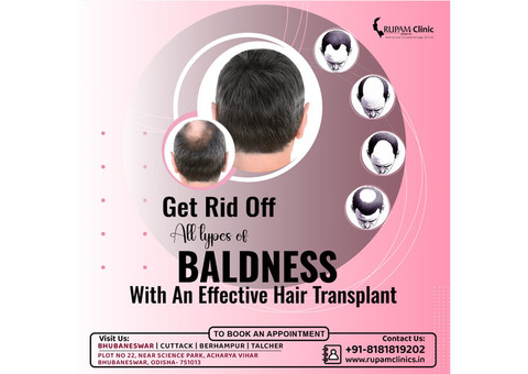 Best Hair Transplant Treatment Clinic in Bhubaneswar