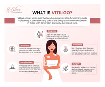 Vitiligo Treatment in Ludhiana: Consult Dr. Shikha Aggarwal