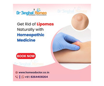 Natural and Effective Lipoma Treatment in Homeopathy