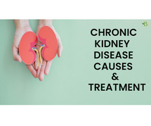Understanding Chronic Kidney Disease: Causes and Treatment Options