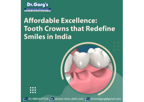 Affordable Excellence: Tooth Crowns that Redefine Smiles in India