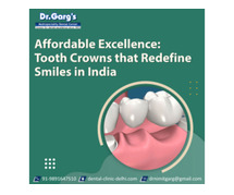 Affordable Excellence: Tooth Crowns that Redefine Smiles in India