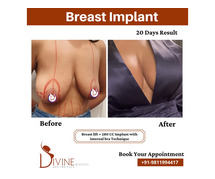 Breast Augmentation with Implant and Lift in India