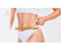 Liposuction In Hyderabad at Eternelle Aesthetics