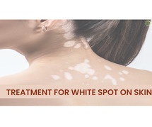 Treating White Spots on the Skin: Effective Strategies