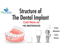 Are You Looking Affordable Dental Implants in Noida?