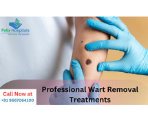 Get Professional Wart Removal Treatments Near Me