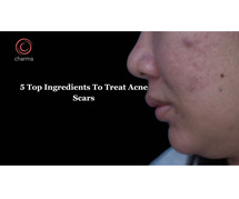 Acne Treatment In Bangalore at Charma Clinic