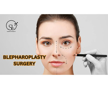 Blepharoplasty Surgery in Hyderabad