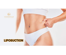 Liposuction In Hyderabad | Eternelle Aesthetics