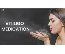 Analyzing the Top Vitiligo Medicines for Effective Treatment