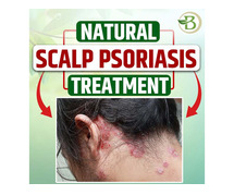 Achieving a Permanent Solution for Psoriasis Naturally