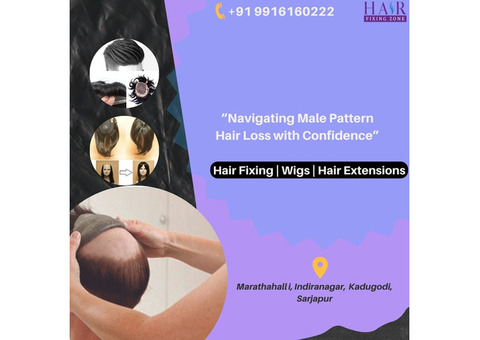 Male Pattern Hair Loss: Hair Replacement Solution
