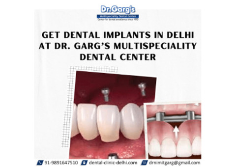 Get Dental Implants in Delhi at Dr. Garg’s Multispeciality Dental Center