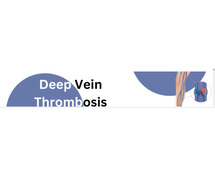 Deep Vein Thrombosis Doctor in Jaipur