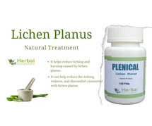 Plenical: Herbal Supplement for Lichen Planus