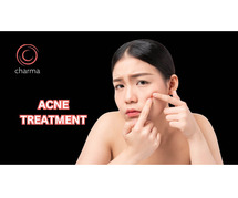 Acne treatment in Bangalore | Charma Clinic