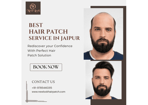 Best Hair Patch Service in Jaipur