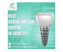 Best Dental Implant Doctor in Gaur City