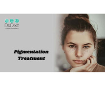 Pigmentation Treatment in Bangalore