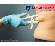Expert Liposuction: Body Fat Removal Delhi by Kosmoderma