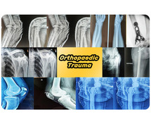 Speed up Your Recovery | Best Arthroscopic Surgeon in Noida