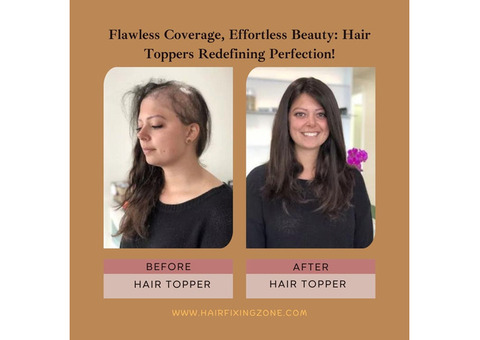 Discover the Confidence-Boosting Benefits of Hair Toppers