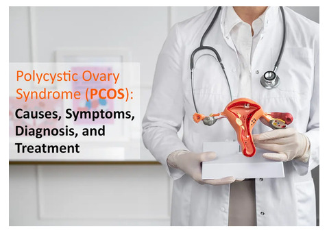 Affordable Treatment for Polycystic Ovaries Syndrome PCOS Near Me