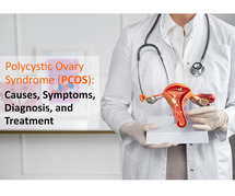 Affordable Treatment for Polycystic Ovaries Syndrome PCOS Near Me