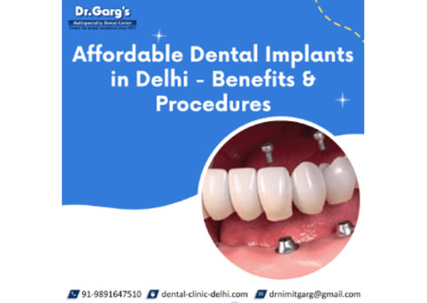 Affordable Dental Implants in Delhi - Benefits & Procedures