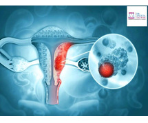 Best Ovarian Cancer Treatment in Whitefield, Manipal