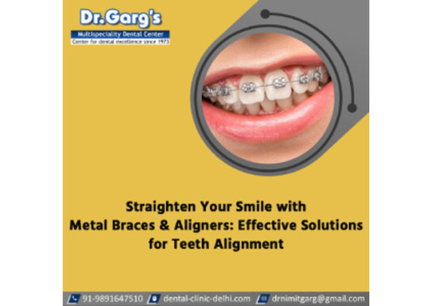 Straighten Your Smile with Metal Braces and Aligners: Effective Solutions for Teeth Alignment