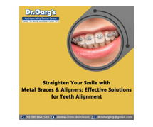 Straighten Your Smile with Metal Braces and Aligners: Effective Solutions for Teeth Alignment