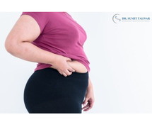 Inadequate Weight Reduction Treatments in Bangalore