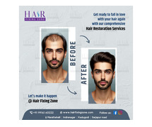 "Best Wig Store in Bangalore | Effective Nonsurgical Hair Patches"