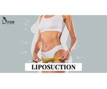 Transform Your Body with Expert Liposuction in India