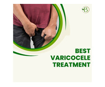 Varicocele treatment without surgery