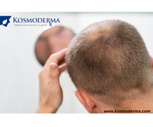 Unveiling Hair Restoration Solutions in Bangalore: Growth Factor & Alopecia Treatments