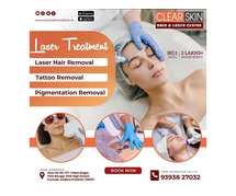 Laser treatment clinic in india