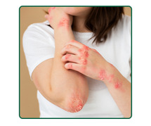 Natural and permanent solution for skin psoriasis