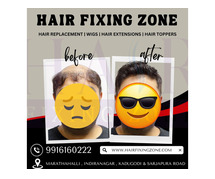 TopQuality Hair Patches for Natural Results at Hair Fixing Zone