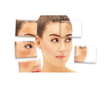 Hyperpigmentation Treatment in Chennai