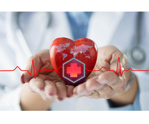 cardiac doctor Delhi