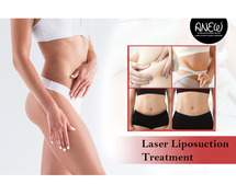 Improve Your Body with Laser Liposuction at Anew Cosmetic Clinic